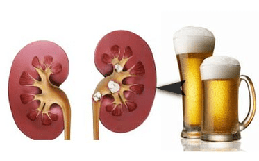 L'effet de l'alcool sur les reins